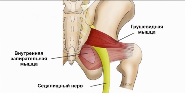 Синдром грушевидной мышцы